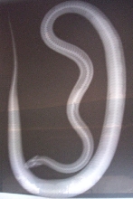 xray 2