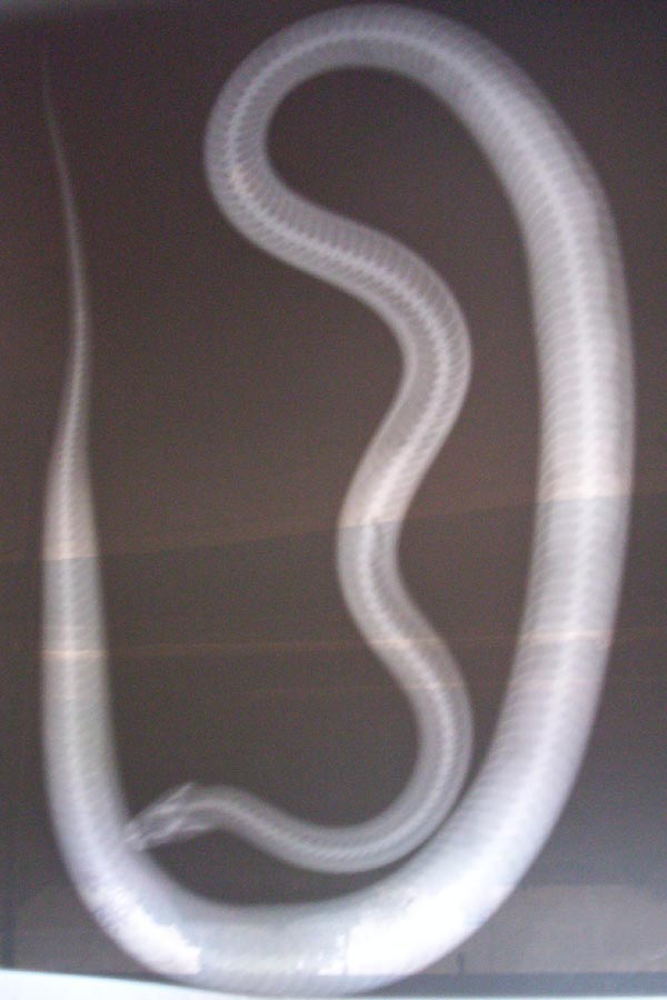 xray 2
