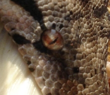 hypo eye
