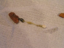 fattie poop