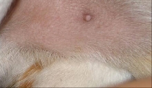 pimple1