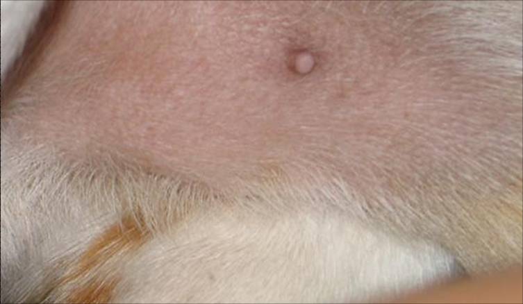 pimple1