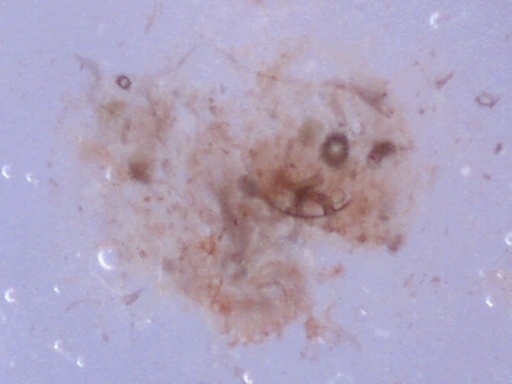 Pnut fecal smear 60X