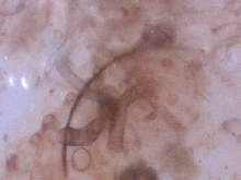 Pnut fecal smear 200X