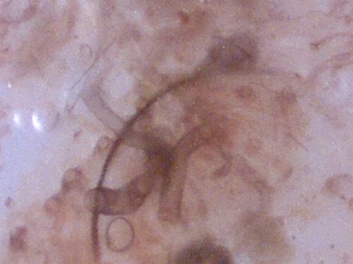 Pnut fecal smear 200X