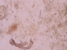 Pnut fecal smear 60X