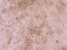 Punkin fecal smear 200X