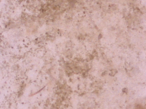 Punkin fecal smear 200X