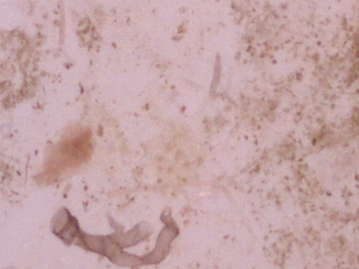 Punkin fecal smear 200X