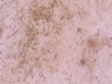 Punkin fecal smear 200X