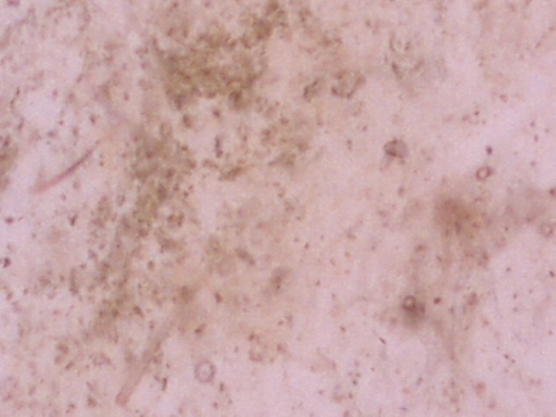 Punkin fecal smear 200X
