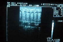 follicles at early stage