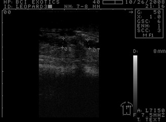 Ultrasound image of follicles