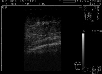 Ultrasound image of follicles