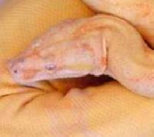 albino