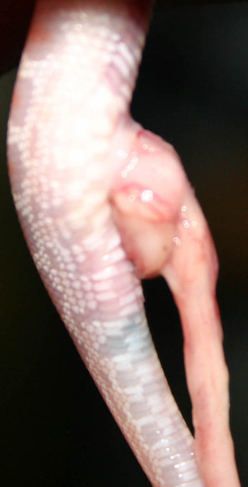 Up close and personal with the umbilical
