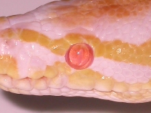 EYE ALBINO