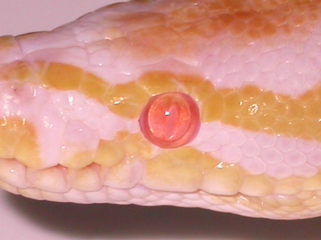 EYE ALBINO