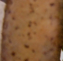egg?   (u. sikorae)