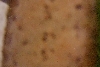 egg? (3)