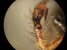 retrolateral tibial apophysis