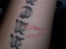 bp bite