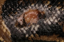 Large sore