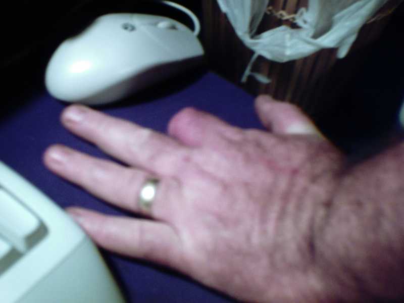 my left hand without my index finger