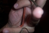 Rhadinaea2