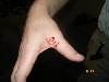 bite