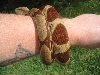 hypo suri around the arm
