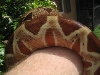 hypo suri around the wrist
