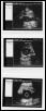 Burmese Python Ovarian Follicles via ultrasound.