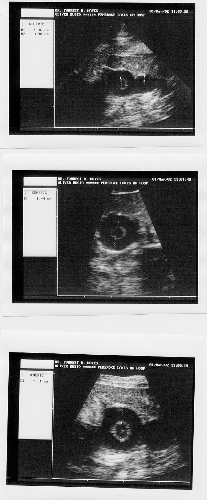 Burmese Python Ovarian Follicles via ultrasound.