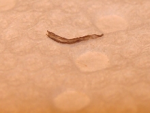 tongue shed(1)