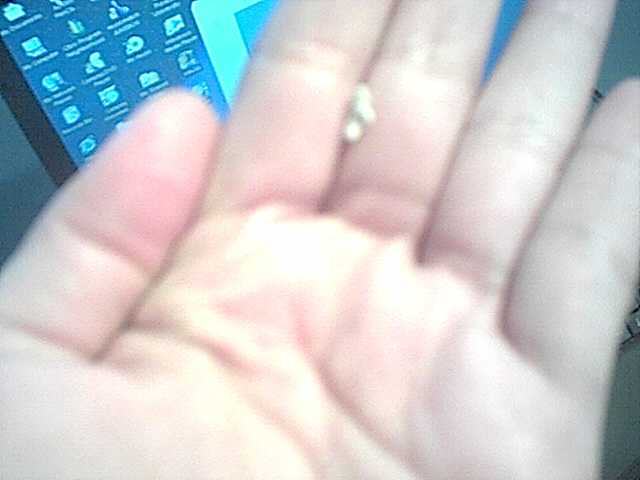 bobby's tooth