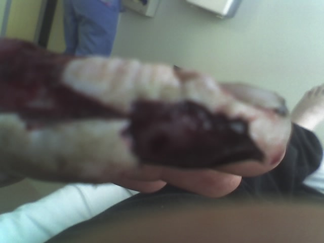ouch