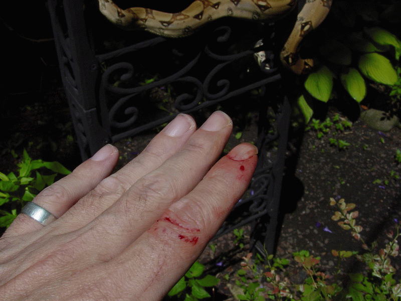 snake bite-Ouch
