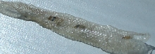 Shed skin from injury