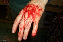 13 Foot Burm Bite