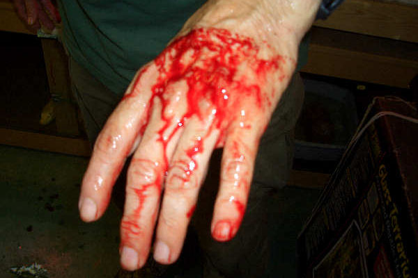 13 Foot Burm Bite