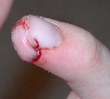 ouch