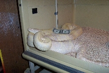 adult albino