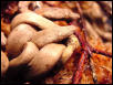 Solomon Ground/Tree Boa
