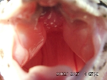 Open up and say ahhhh