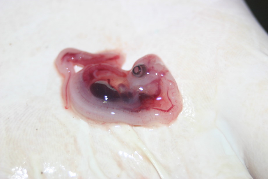 Embryo
