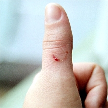 Bud Bite