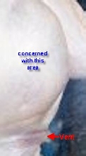 ACF Allie Leg