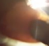 Allie Leg B