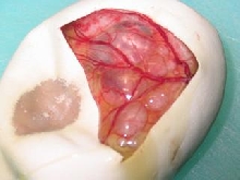 short tailed python egg